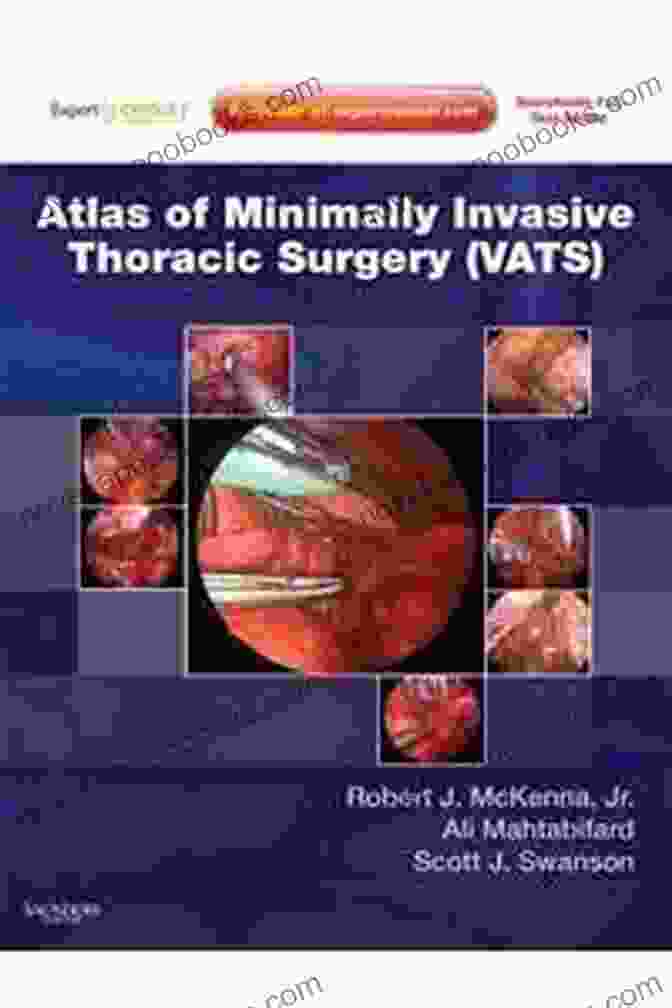 Atlas Of VATS Atlas Of Minimally Invasive Thoracic Surgery (VATS): Expert Consult