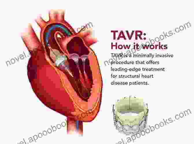 Become Familiar With The Range Of Surgical Techniques Used In Cardiac Surgery. AN TO CARDIAC SURGERY FOR ANESTHESIA PROVIDERS: UNDERSTANDING CARDIAC SURGICAL PROCEDURES FOR ANESTHESIA RESIDENTS AND STUDENT NURSE ANESTHETISTS