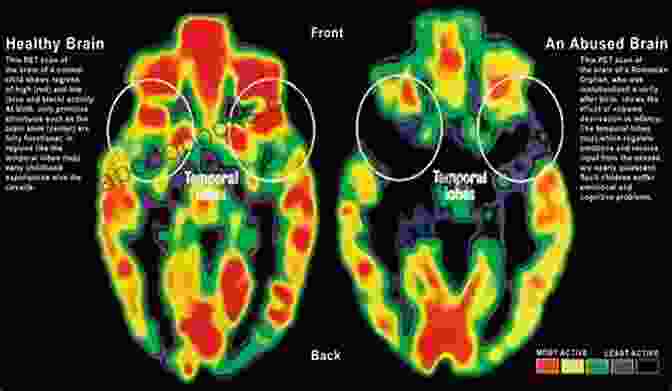 Brain Scan Showing Connections Between People The Connected Life: The Art And Science Of Relational Spirituality