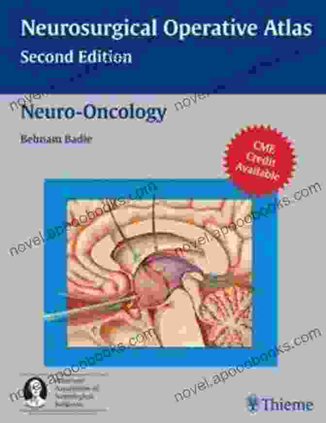 Neuro Oncology Neurosurgical Operative Atlas Book Cover Neuro Oncology (Neurosurgical Operative Atlas) Percy Rossell Perry