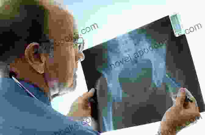 Orthopedic Surgeon Examining An X Ray Of A Fractured Bone Fracture Care An Issue Of Orthopedic Clinics E (The Clinics: Orthopedics)