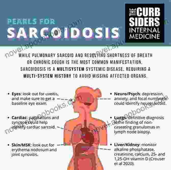 Sarcoidosis Diagnosis Atlas Of Sarcoidosis: Pathogenesis Diagnosis And Clinical Features