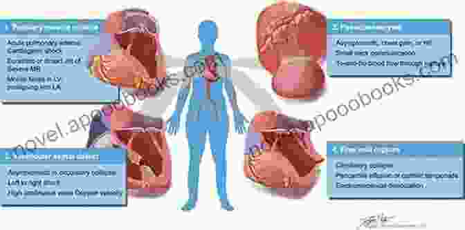 Stay Ahead Of Potential Complications During Cardiac Surgery. AN TO CARDIAC SURGERY FOR ANESTHESIA PROVIDERS: UNDERSTANDING CARDIAC SURGICAL PROCEDURES FOR ANESTHESIA RESIDENTS AND STUDENT NURSE ANESTHETISTS