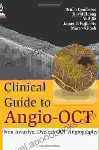 Clinical Guide to Angio OCT: Non Invasive Dyeless OCT Angiography