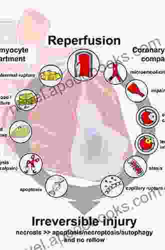 Management Of Myocardial Reperfusion Injury