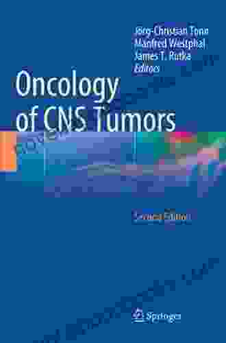 Oncology of CNS Tumors Pamela Burford