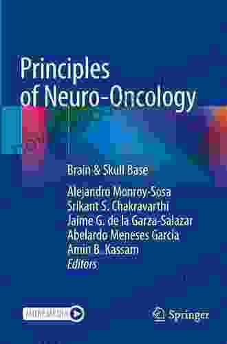 Principles Of Neuro Oncology: Brain Skull Base