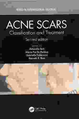 Acne Scars: Classification And Treatment (Series In Dermatological Treatment 6)